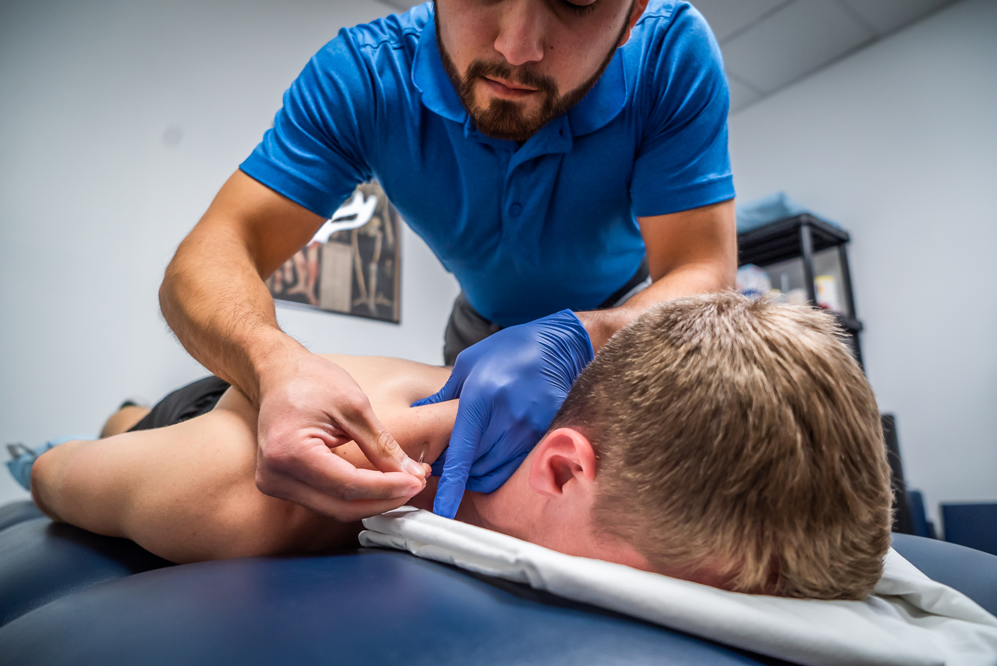 Anthony, Dry Needling Anthony, Dry Needling